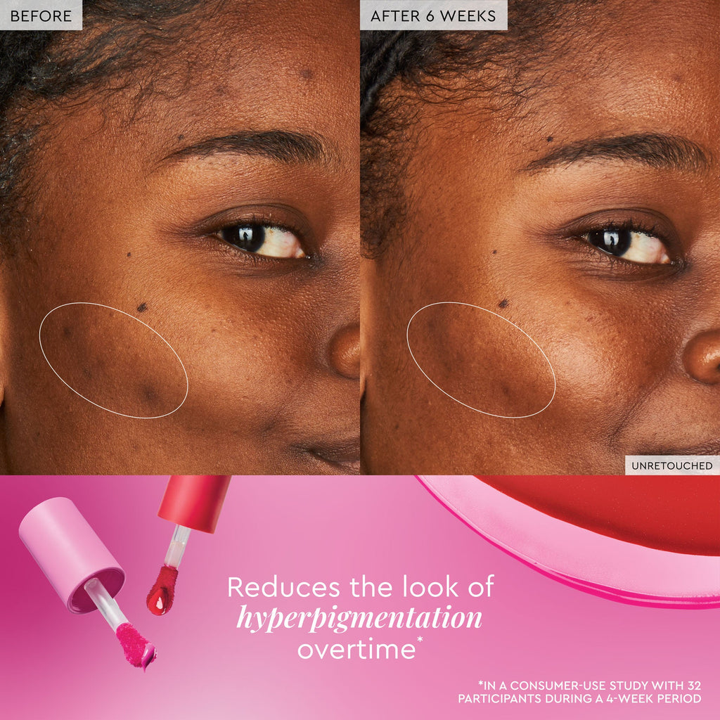 Watermelon Glow Niacinamide Dewy Flush