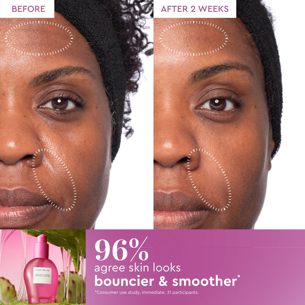 Cool, Calm, and Glowing Skin Fridge Kit